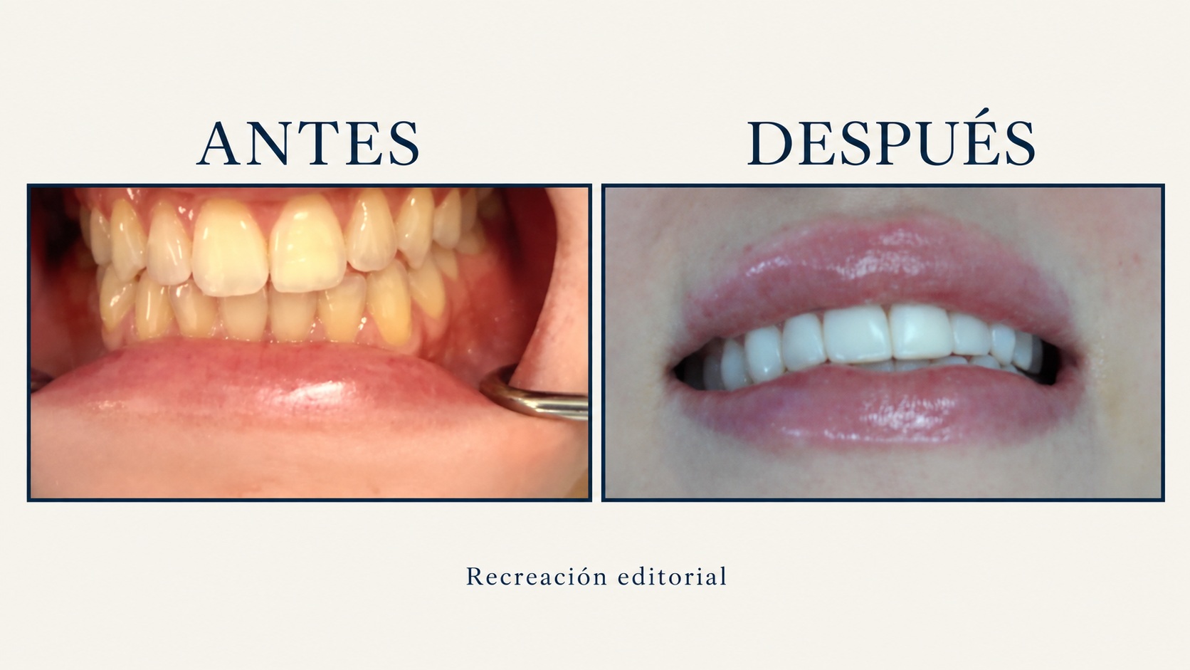 Antes y después · composición editorial