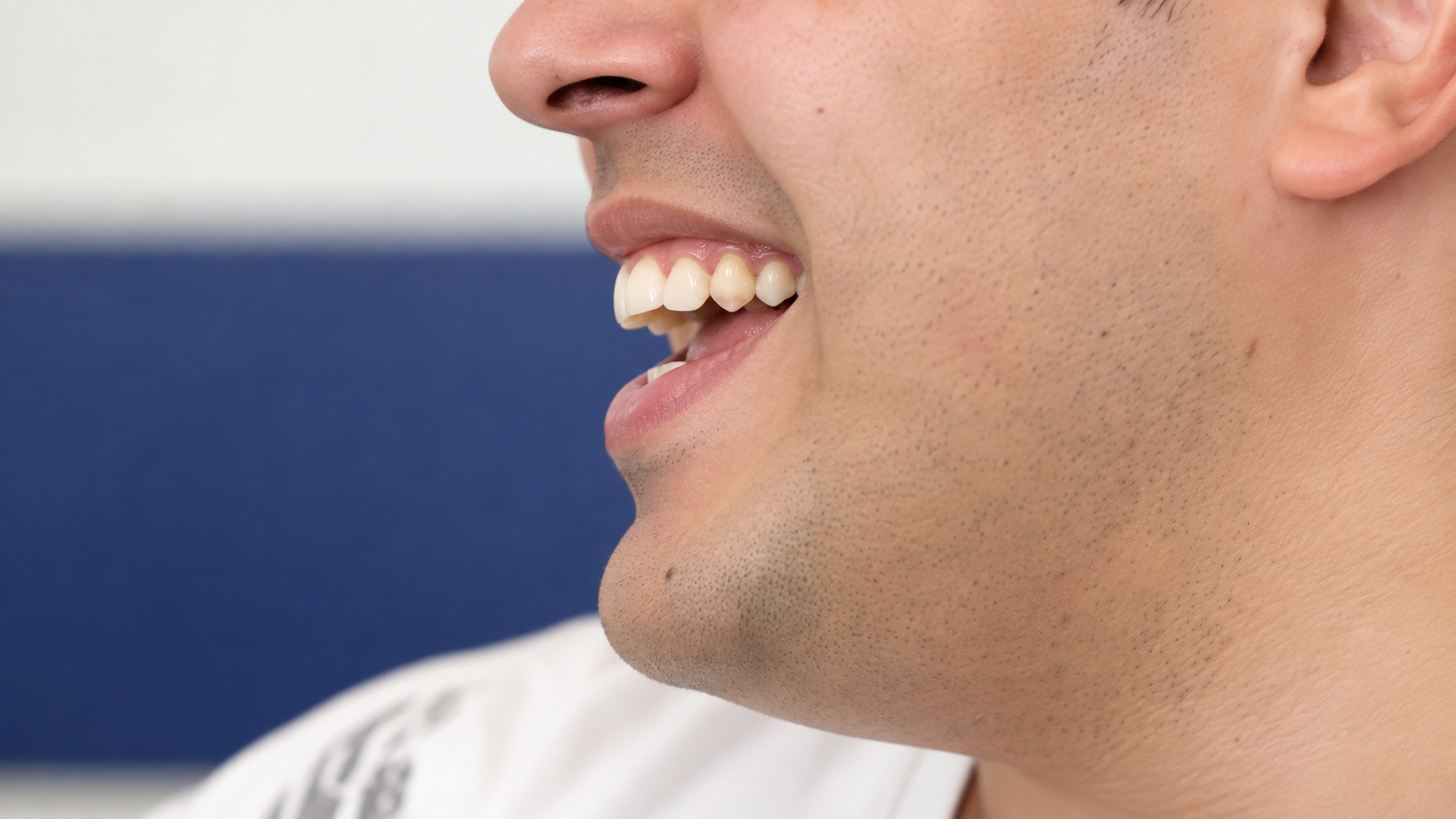 Detalle editorial de la sonrisa de Oso durante la entrevista.
