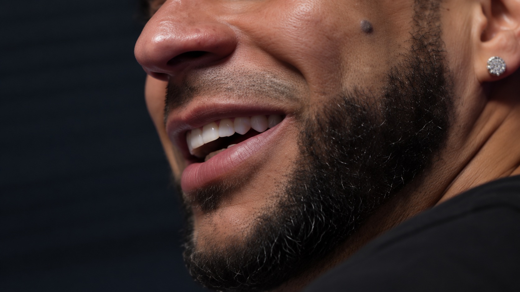 La sonrisa del paciente desde un ángulo lateral.