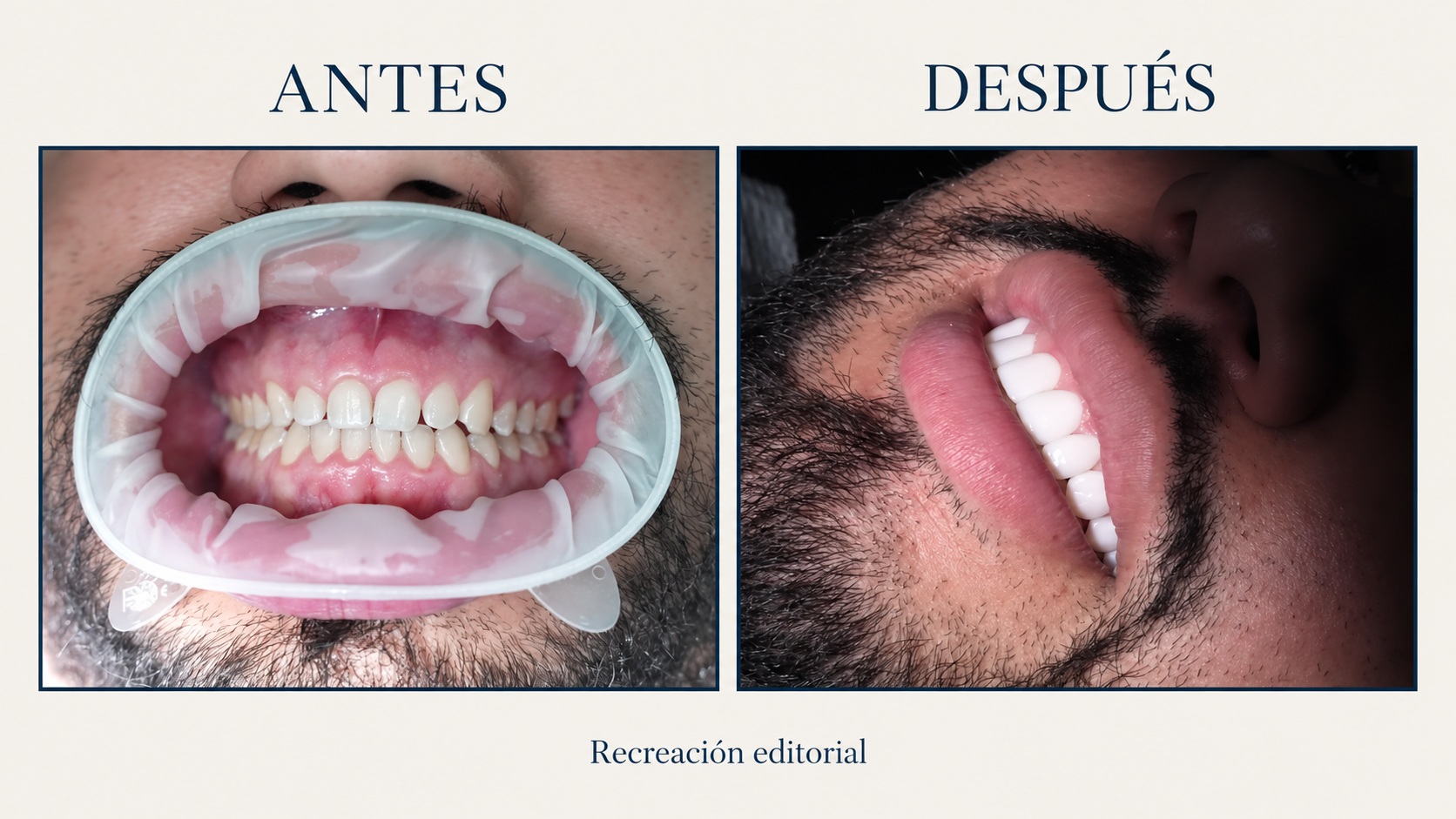 Antes y después · composición editorial