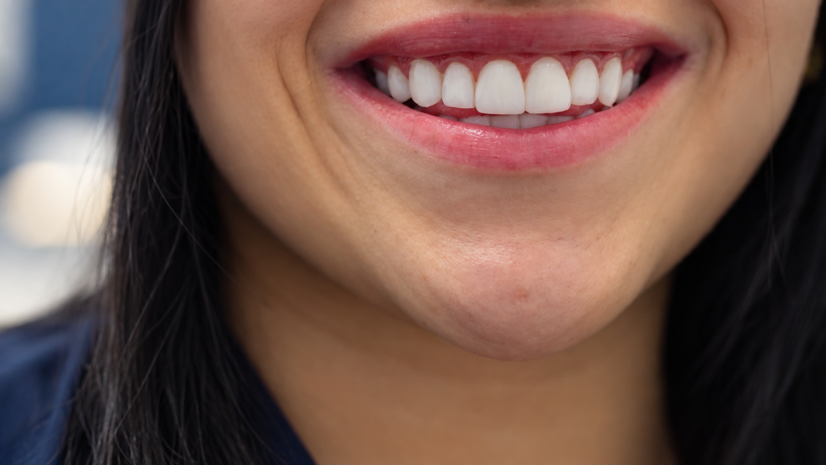 La sonrisa, de cerca · Imagen editorial generada