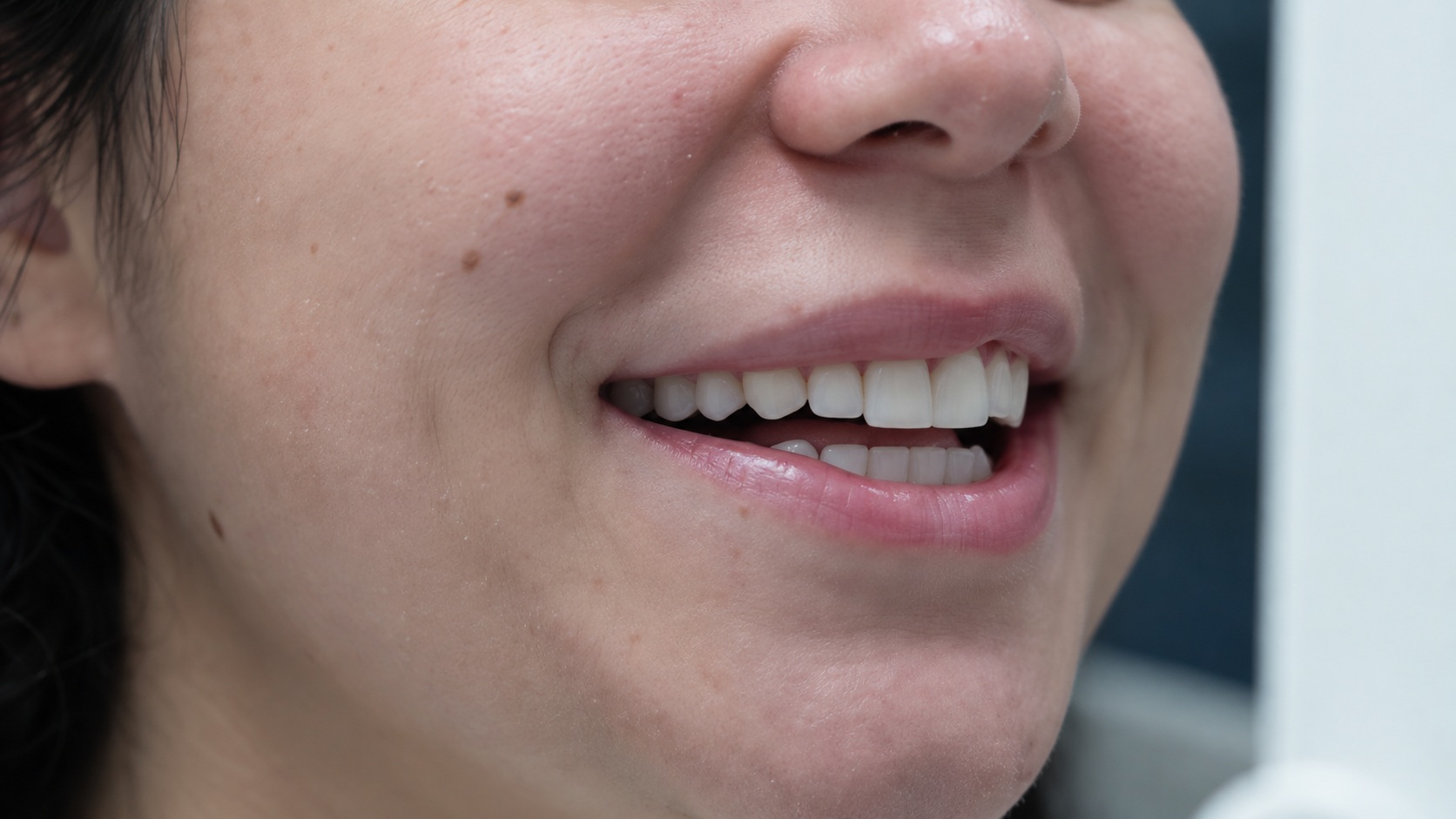 Detalle editorial de la sonrisa en consulta.