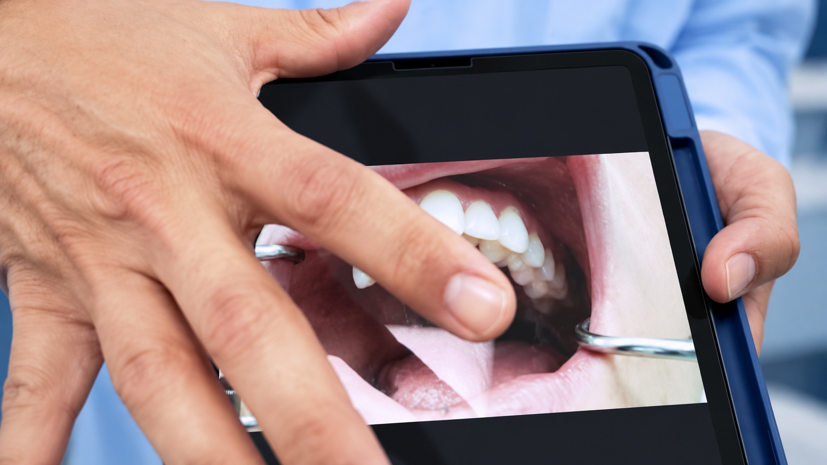 Revisando el registro dental · Recreación editorial